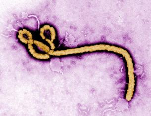 エボラ出血熱